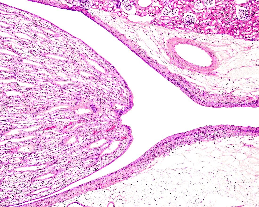 Renal pelvis, light micrograph