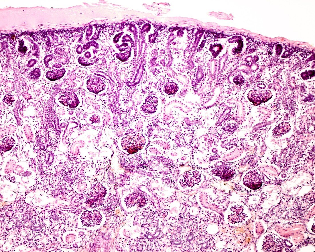 Foetal kidney, light micrograph