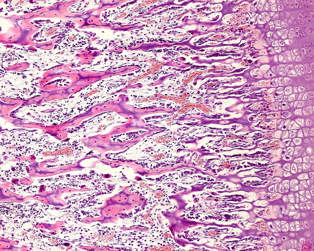 Epiphyseal growth plate, light micrograph