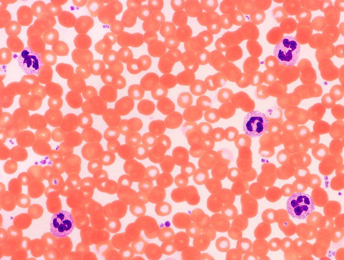 Blood smear, LM