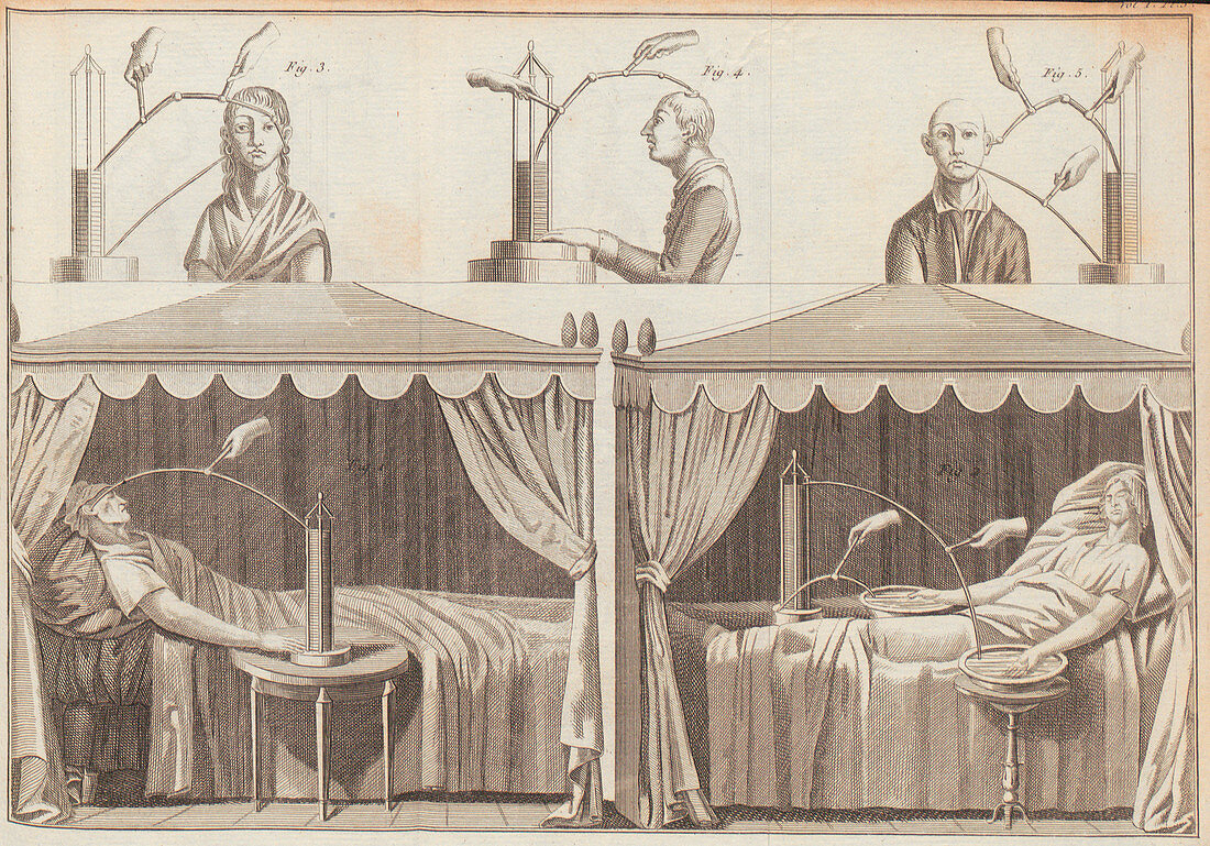 Galvani's human experiments, illustration