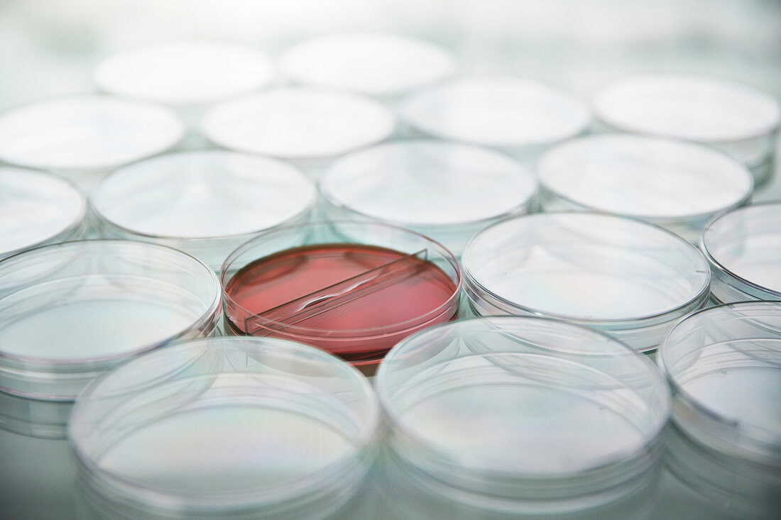 Red cultures in petri dish