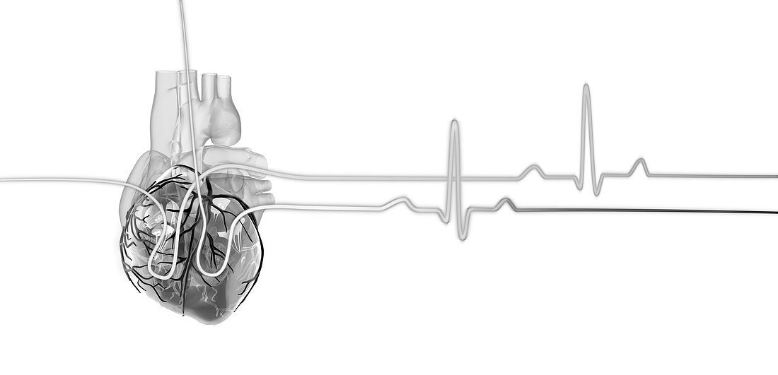 Human heart with a heartbeat trace, illustration