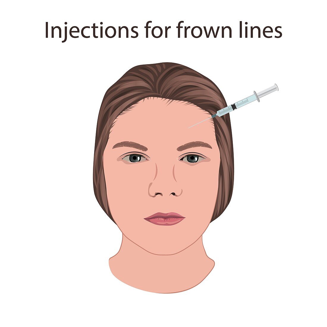 Injections for frown lines, illustration