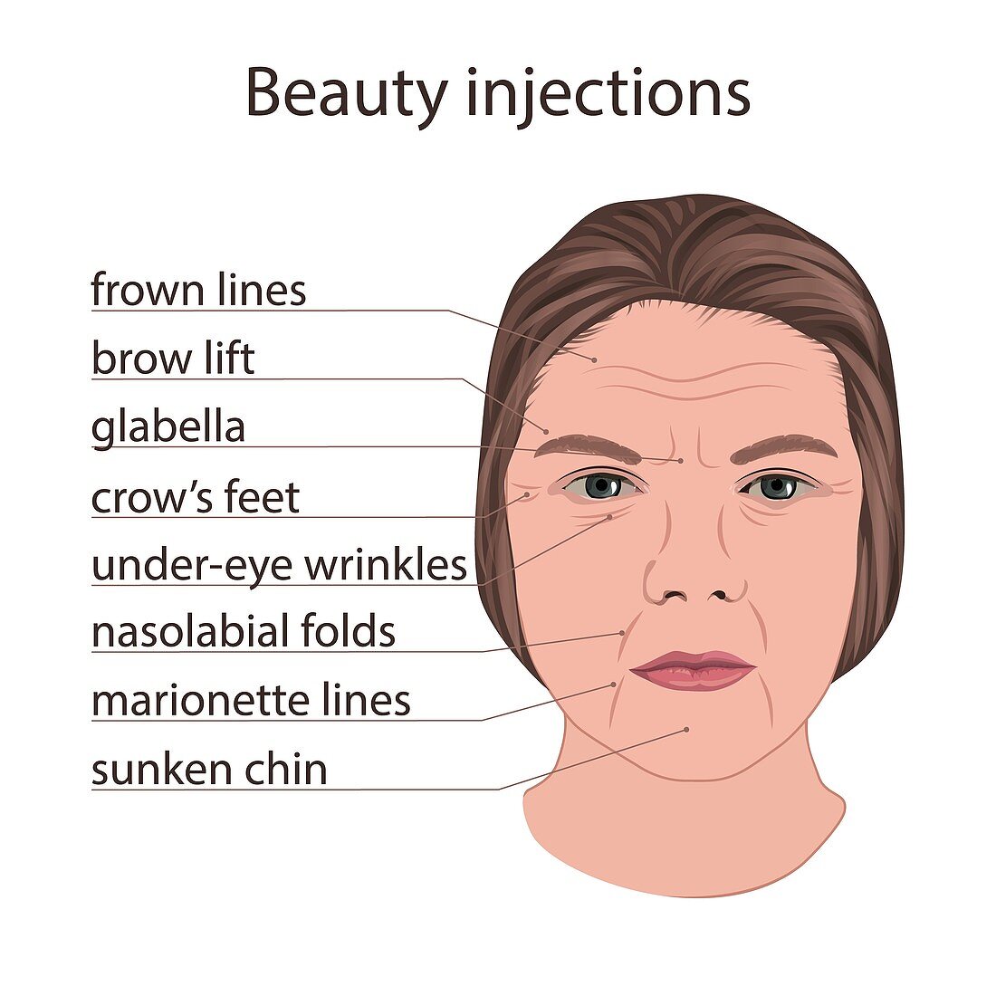 Scheme for beauty injections, illustration