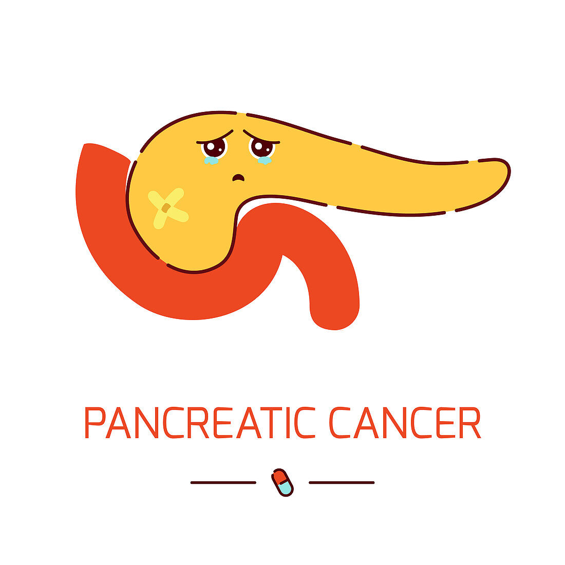 Pancreatic cancer, conceptual illustration