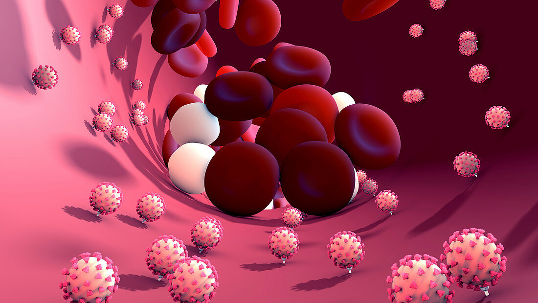 Coronavirus infection, conceptual illustration