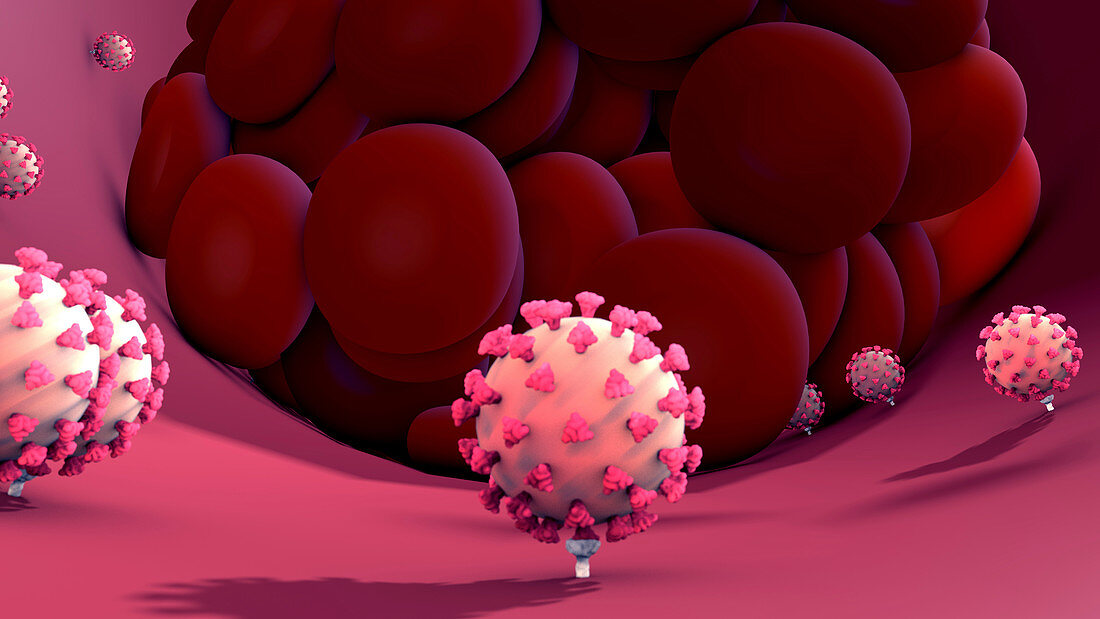 Coronavirus infection, conceptual illustration