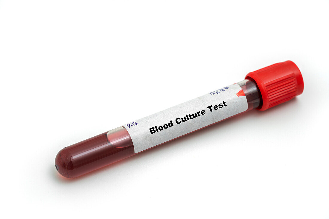 Blood culture test, conceptual image