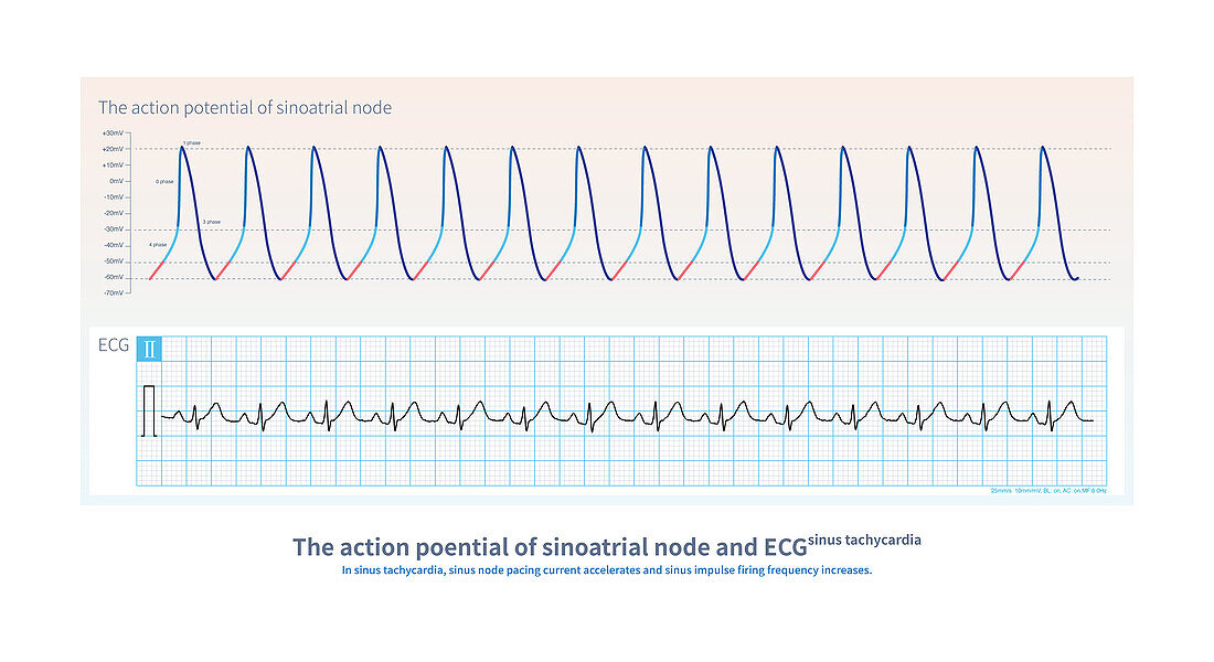 Action potential of sinoatrial node and ECG, illustration