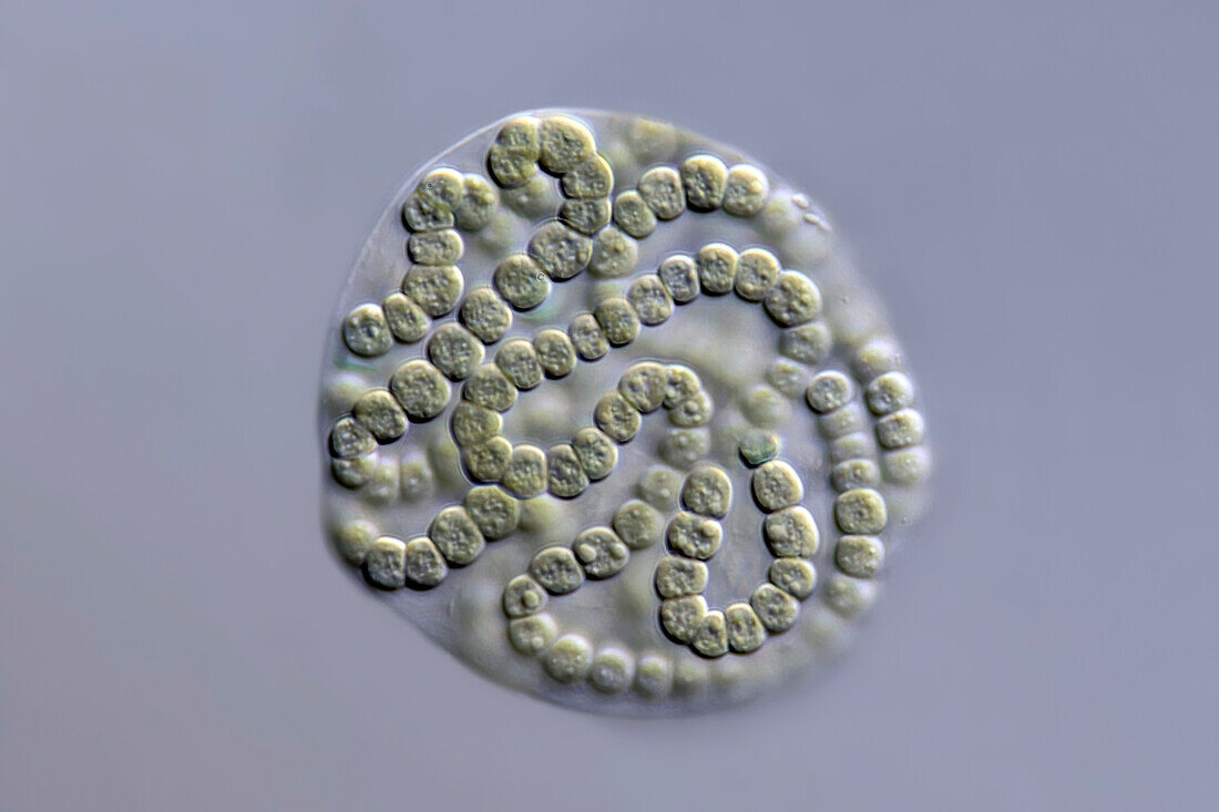 Nostoc-like cyanobacteria, light micrograph