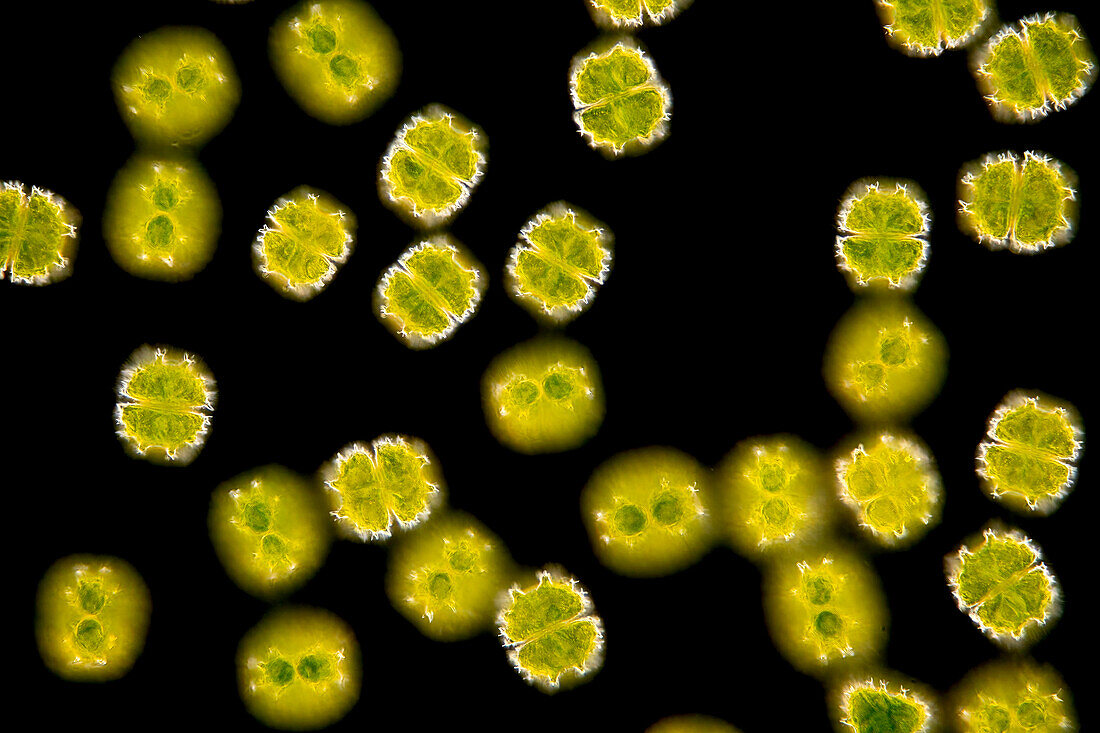 Staurastrum forficulatum algae, light micrograph
