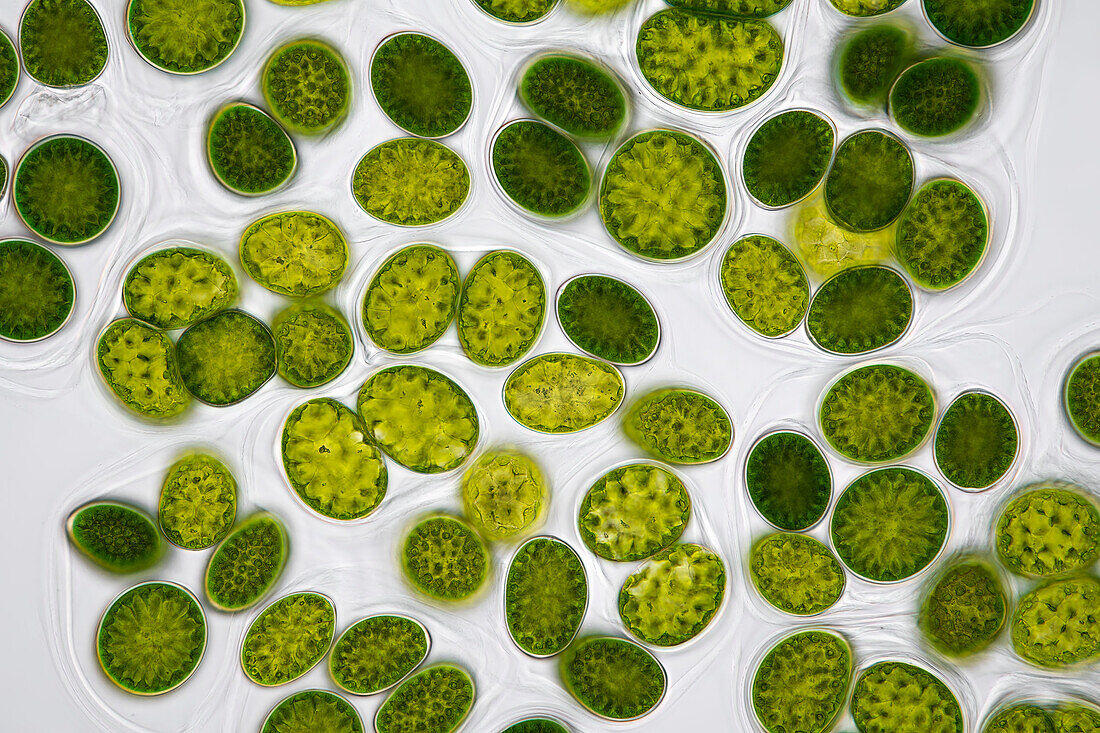 Neglectella eremosphaerophila algae, light micrograph