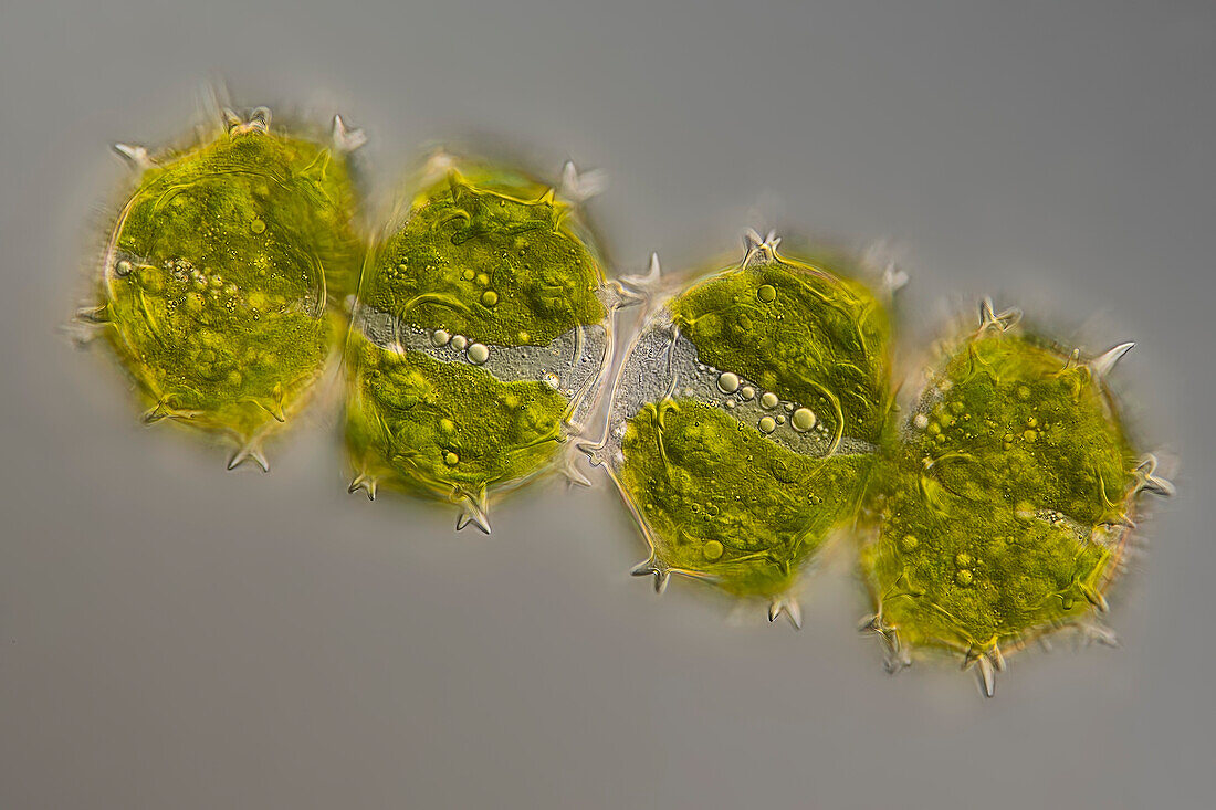 Xanthidium armatum algae, light micrograph