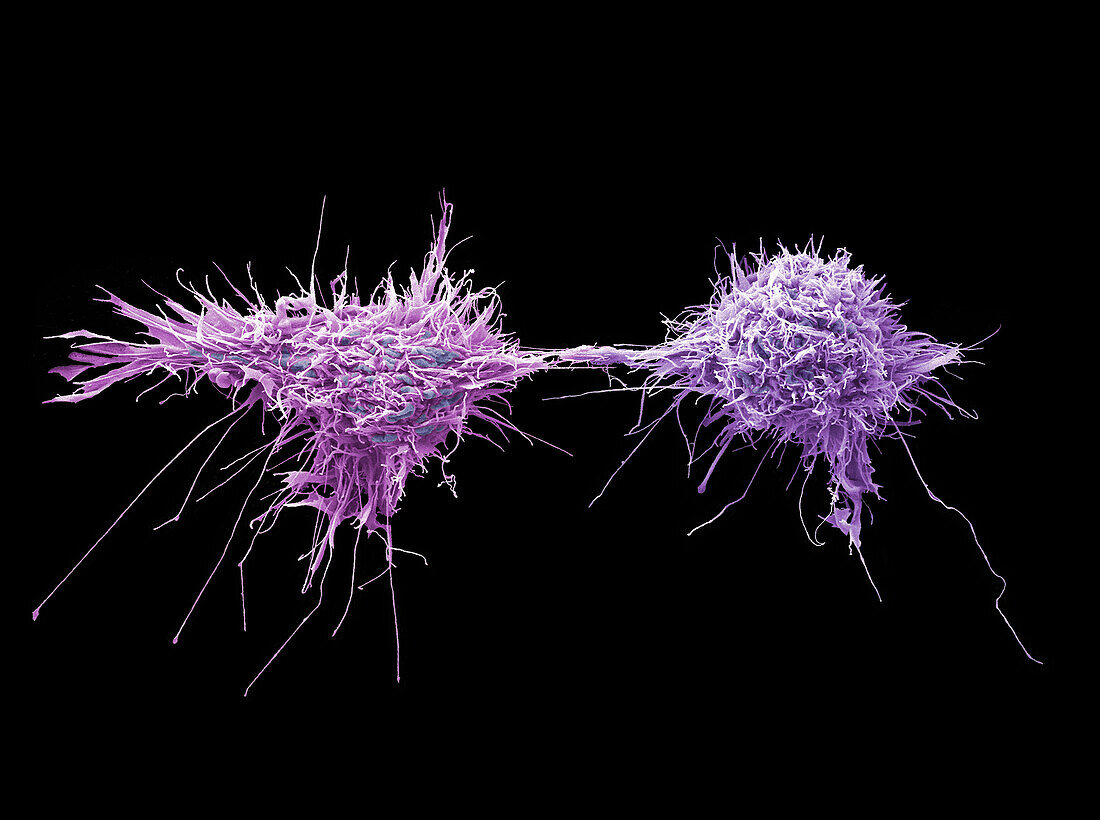 Cervical cancer cells dividing, SEM