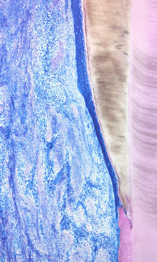 Human junctional epithelium, light micrograph