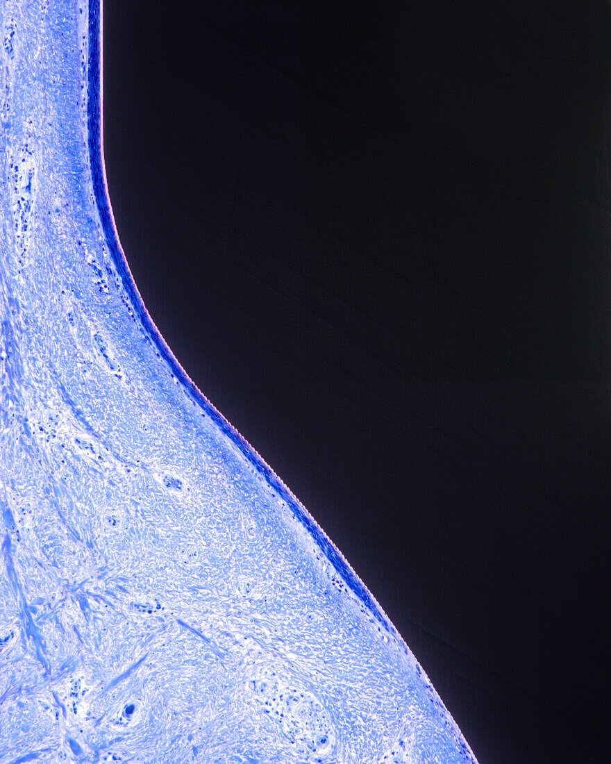Peri-implant junctional epithelium, light micrograph