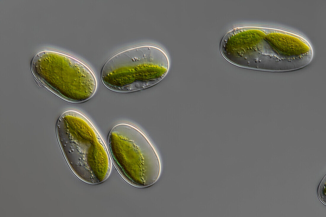 Mesotaenium chlamydosporum algae, light micrograph