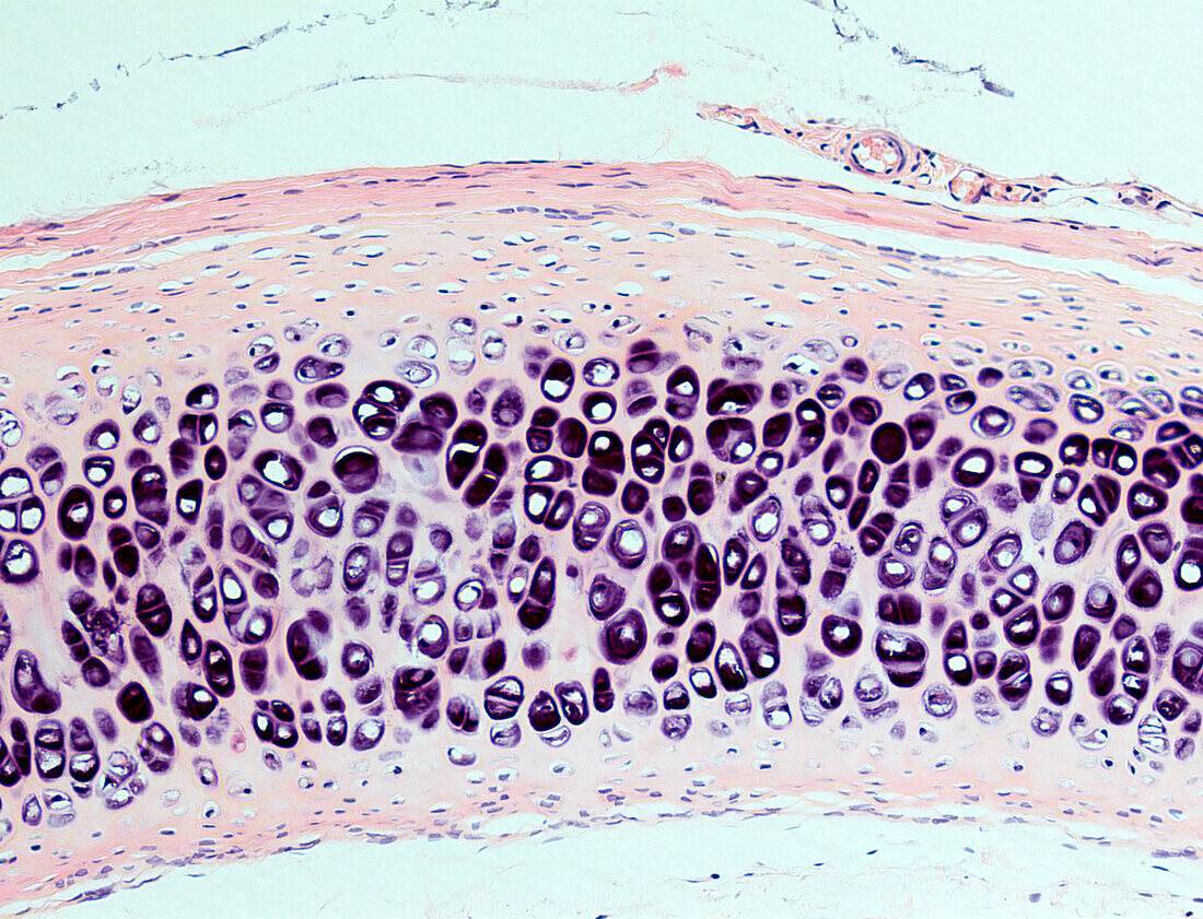 Hyaline cartilage, light micrograph