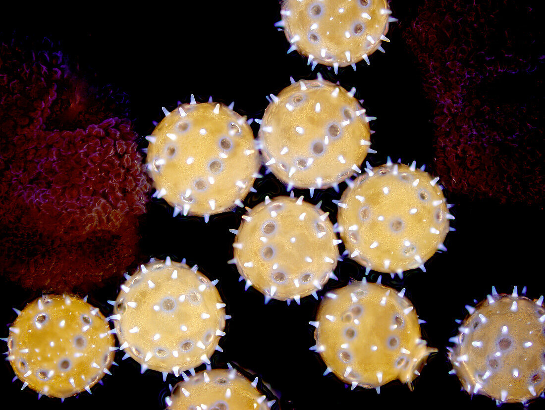 Albizia julibrissin pollen grains, light micrograph