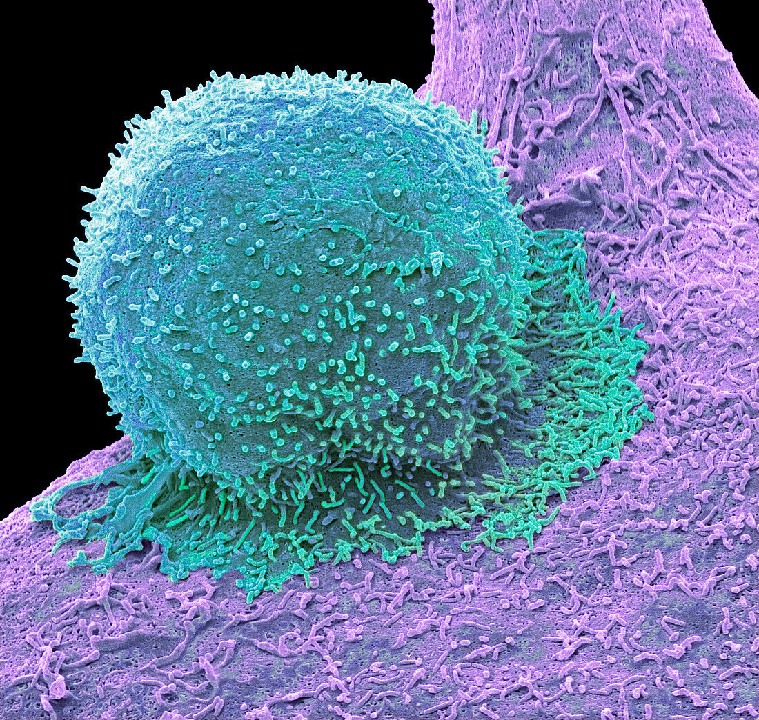 CAR T-cell therapy, SEM