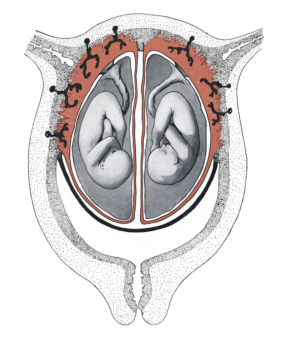Twin foetuses, illustration