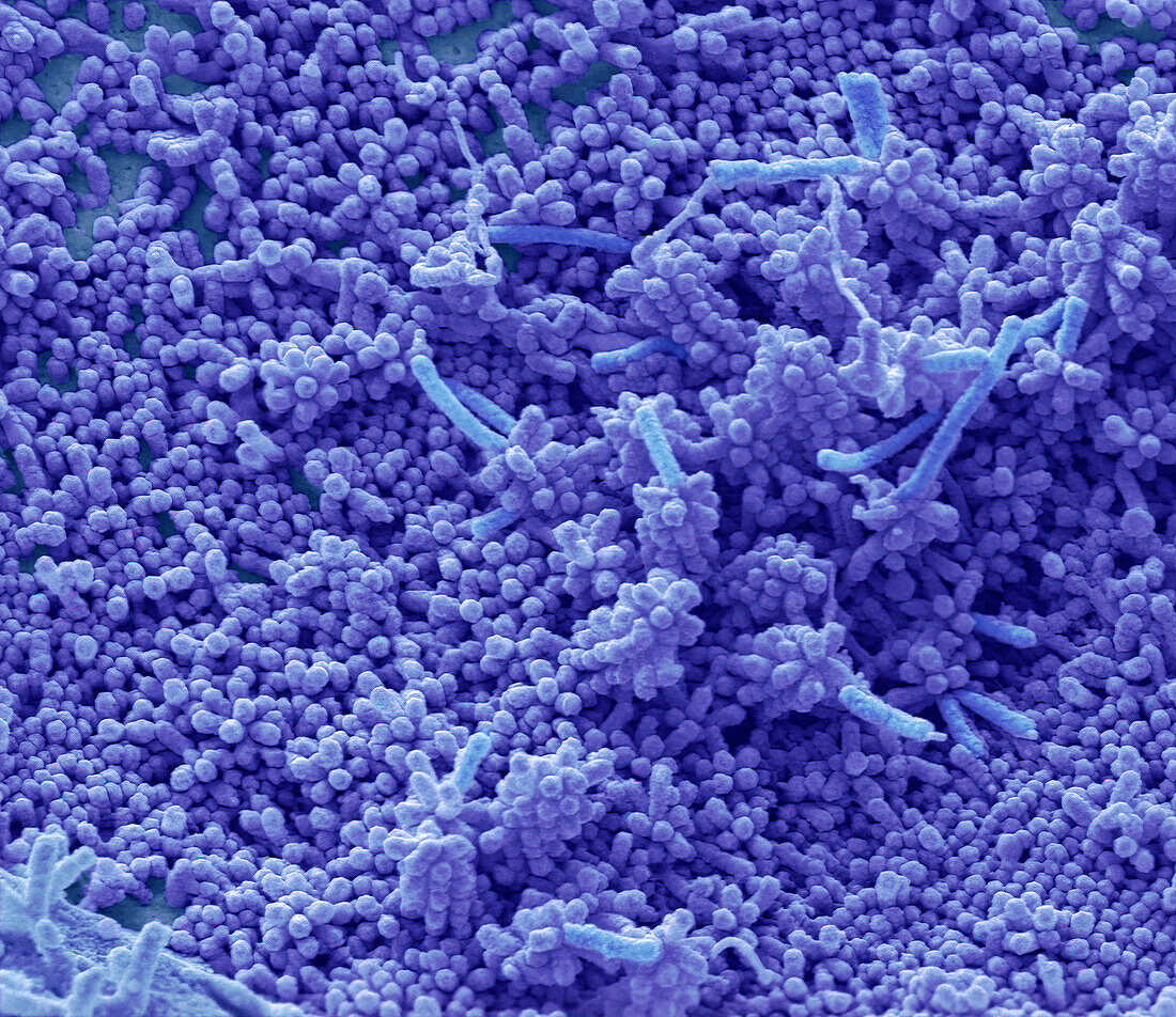 Influenza virus, SEM