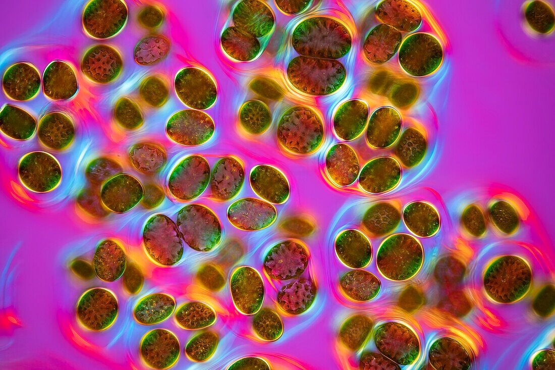 Neglectella eremosphaerophila algae, light micrograph