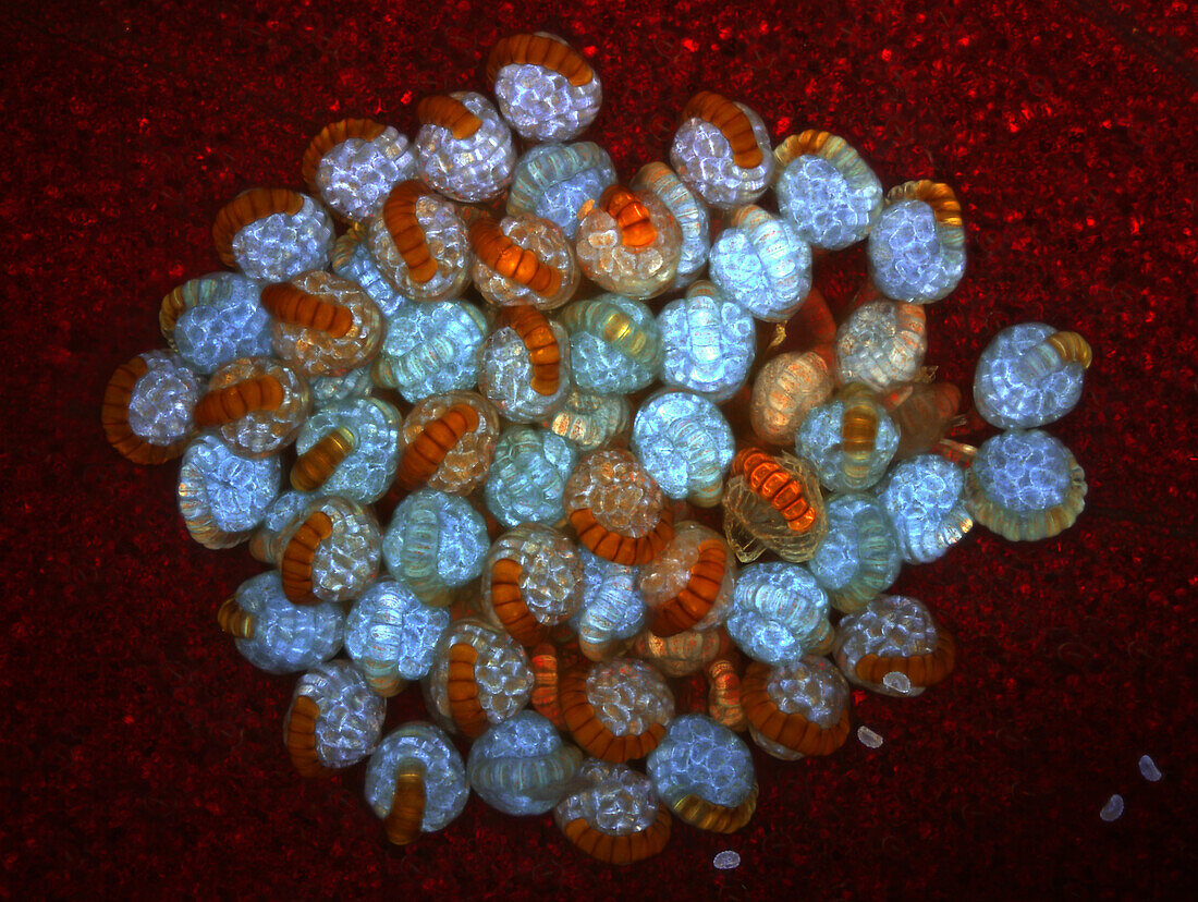 Fern sporangia in sorus, light micrograph