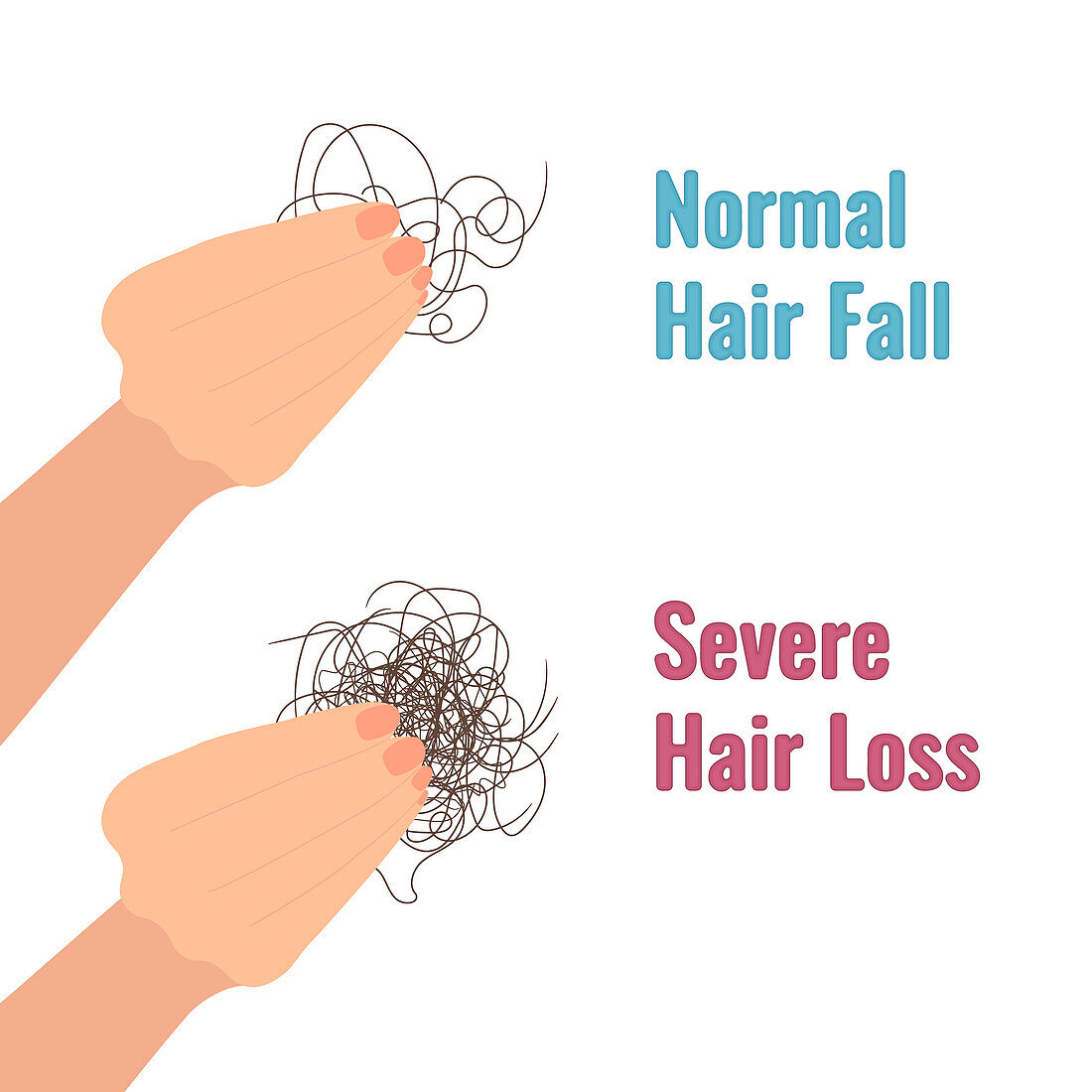 Hair shedding versus hair loss, conceptual illustration