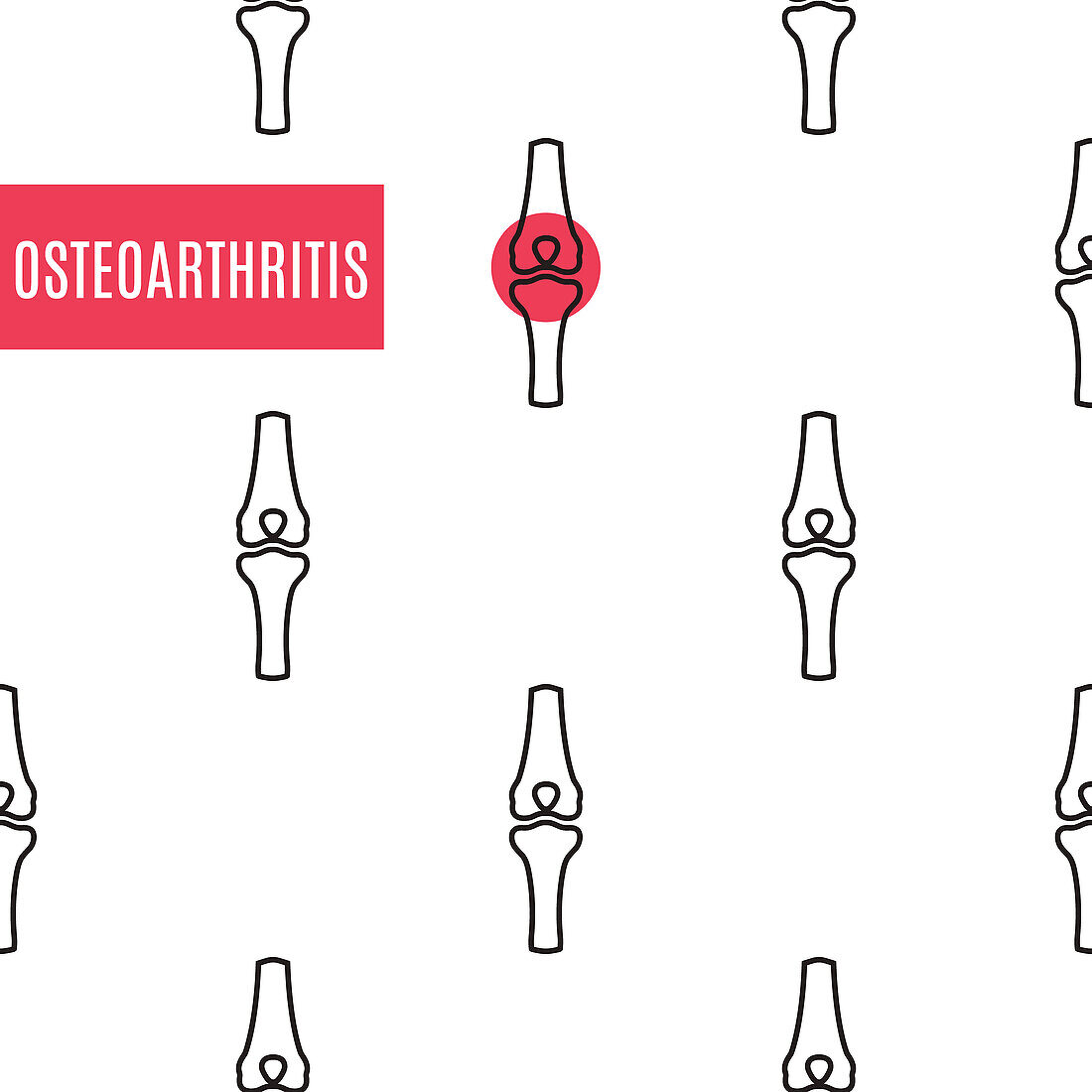 Osteoarthritis, conceptual illustration