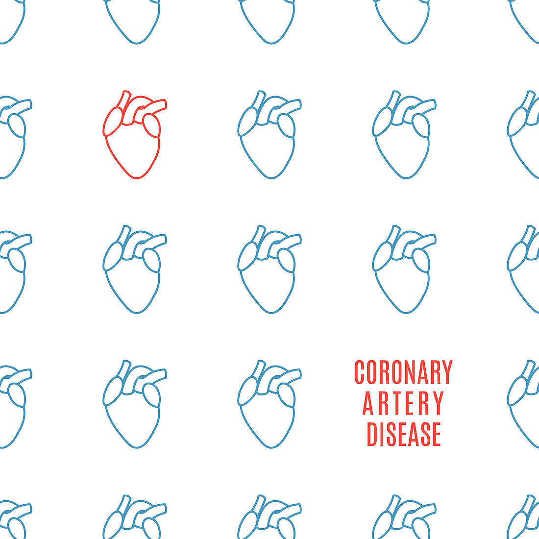 Coronary artery disease, conceptual illustration