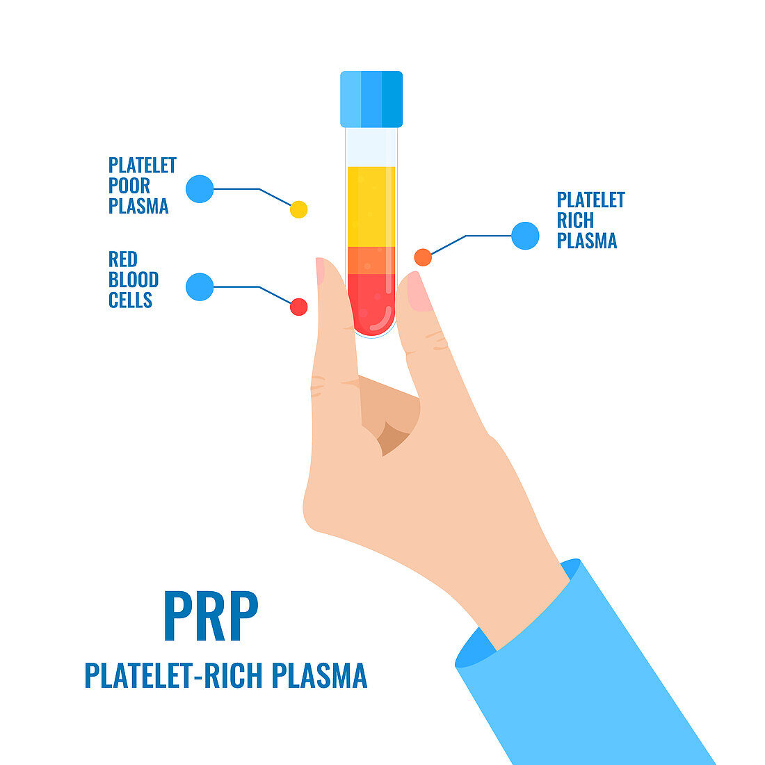 PRP blood composition, conceptual illustration