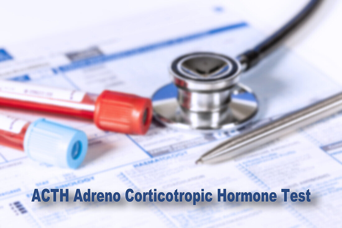 Adreno corticotropic hormone test, conceptual image