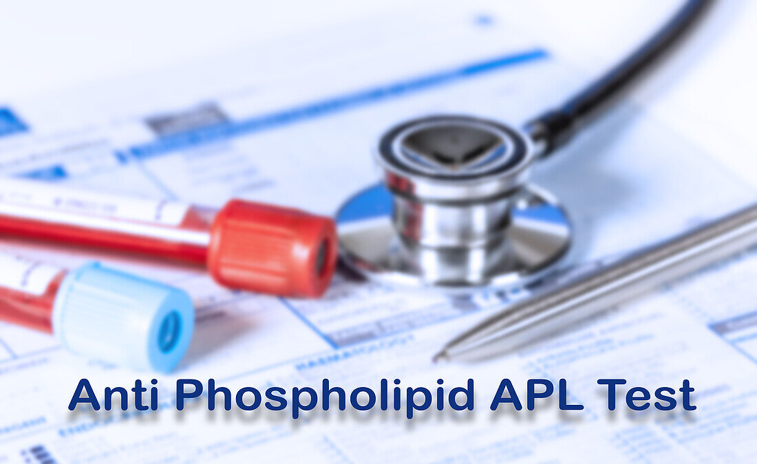 Anti phospholipid test, conceptual image