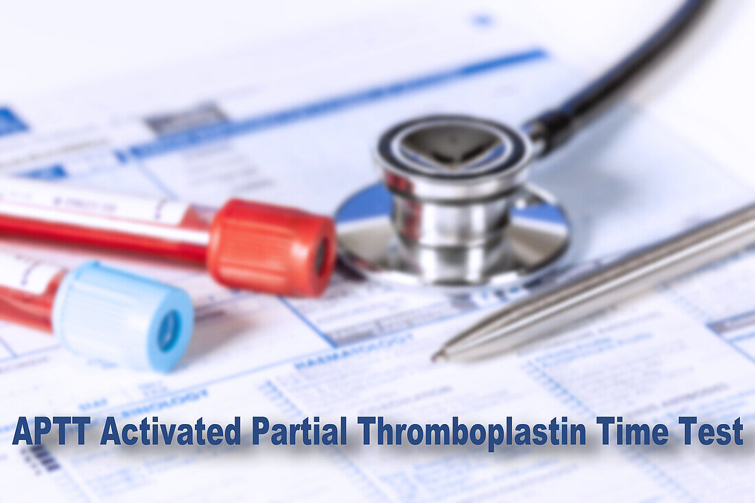 Activated partial thromboplastin time test, conceptual image
