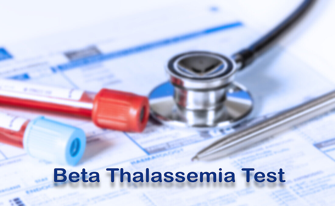 Beta thalassemia test, conceptual image