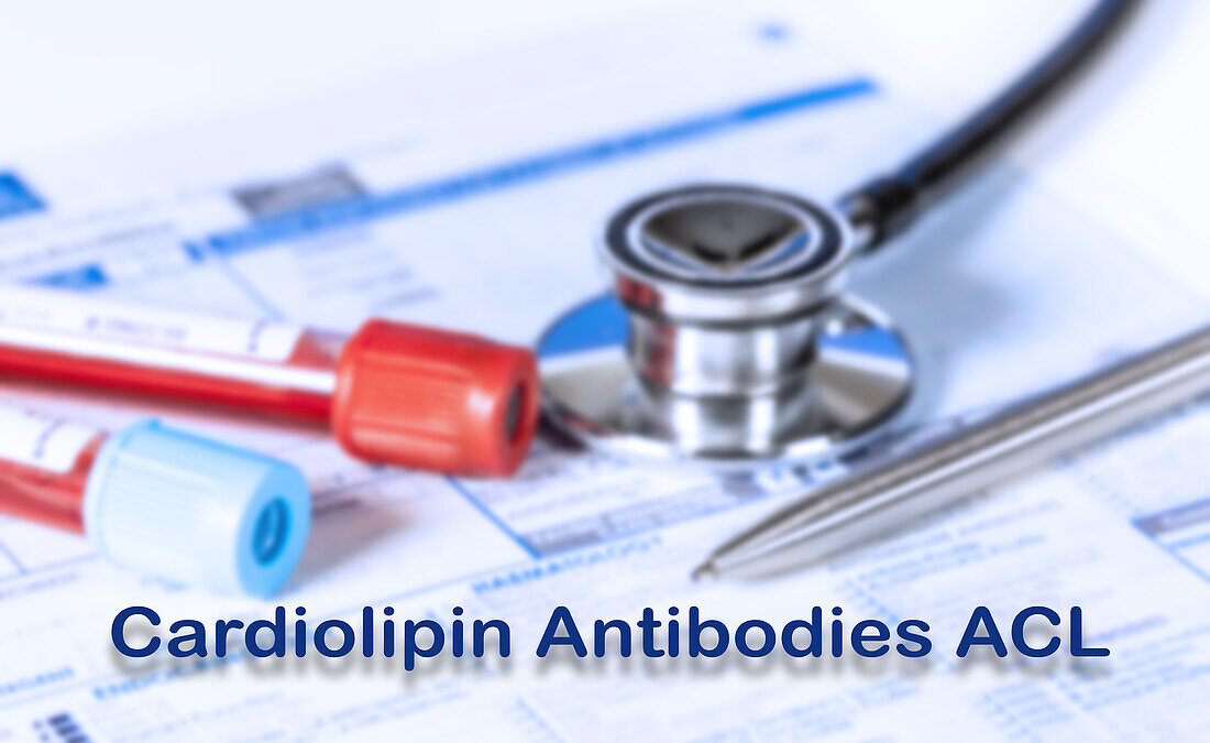 Cardiolipin antibodies test, conceptual image