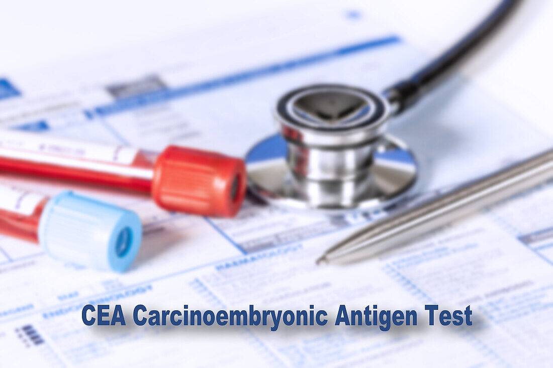 Carcinoembryonic antigen test, conceptual image