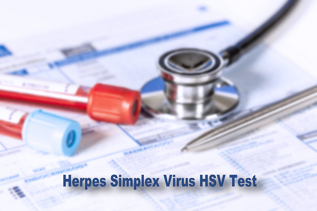 Herpes simplex virus test, conceptual image