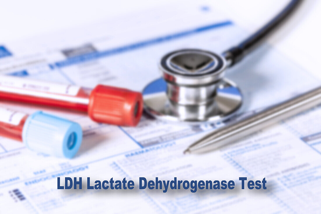 Lactate dehydrogenase test, conceptual image