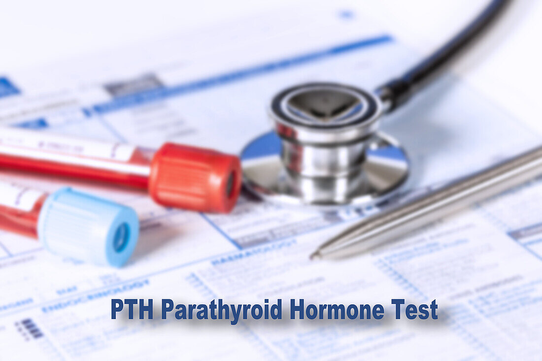 Parathyroid hormone test, conceptual image