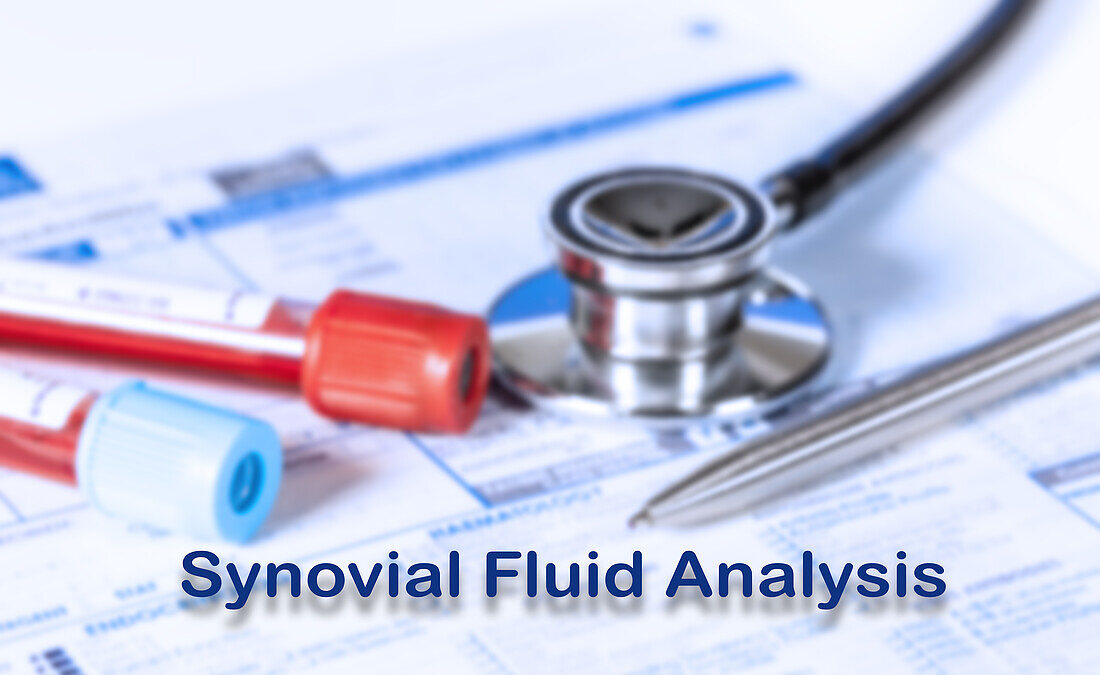 Synovial fluid analysis test, conceptual image