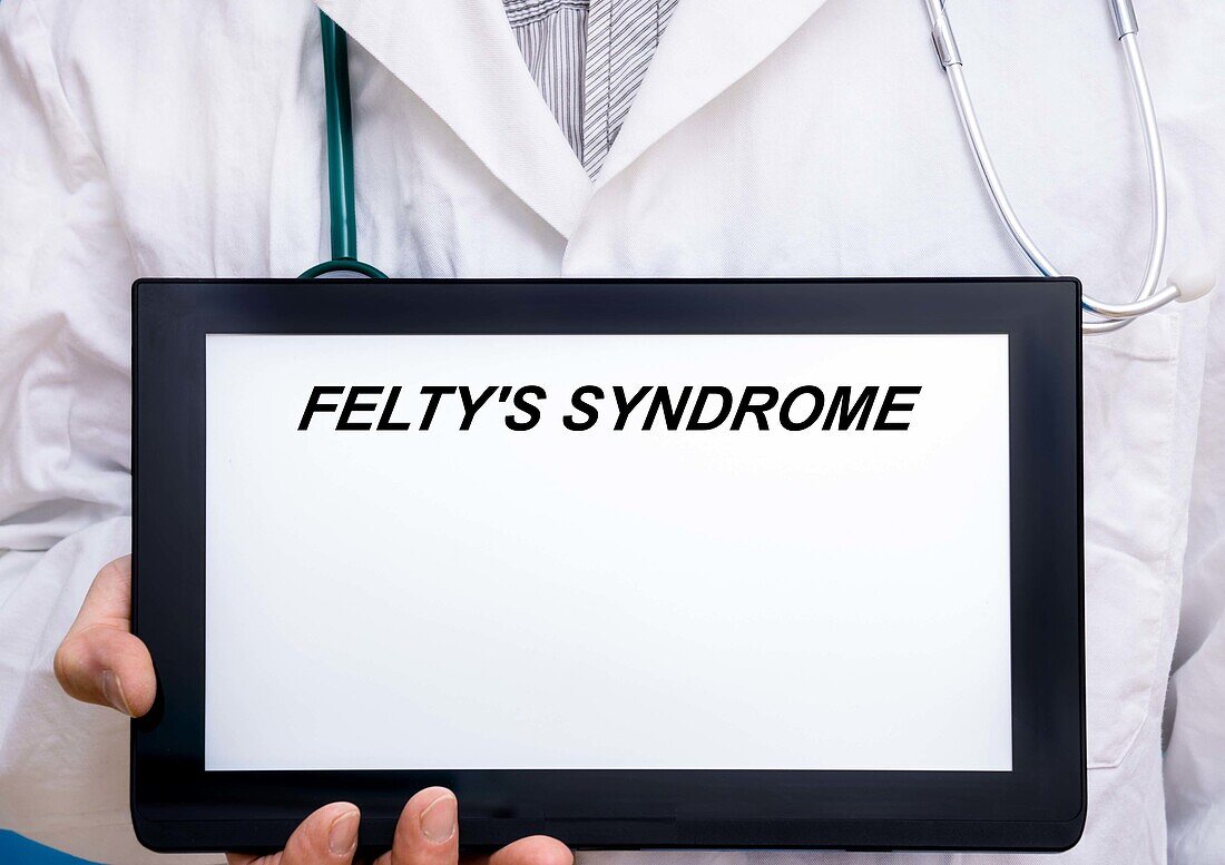 Felty's syndrome, conceptual image