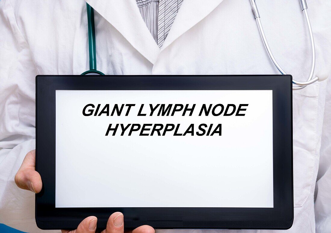 Giant lymph node hyperplasia, conceptual image
