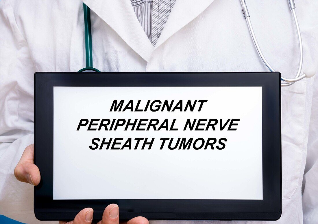 Malignant peripheral nerve sheath tumours, conceptual image