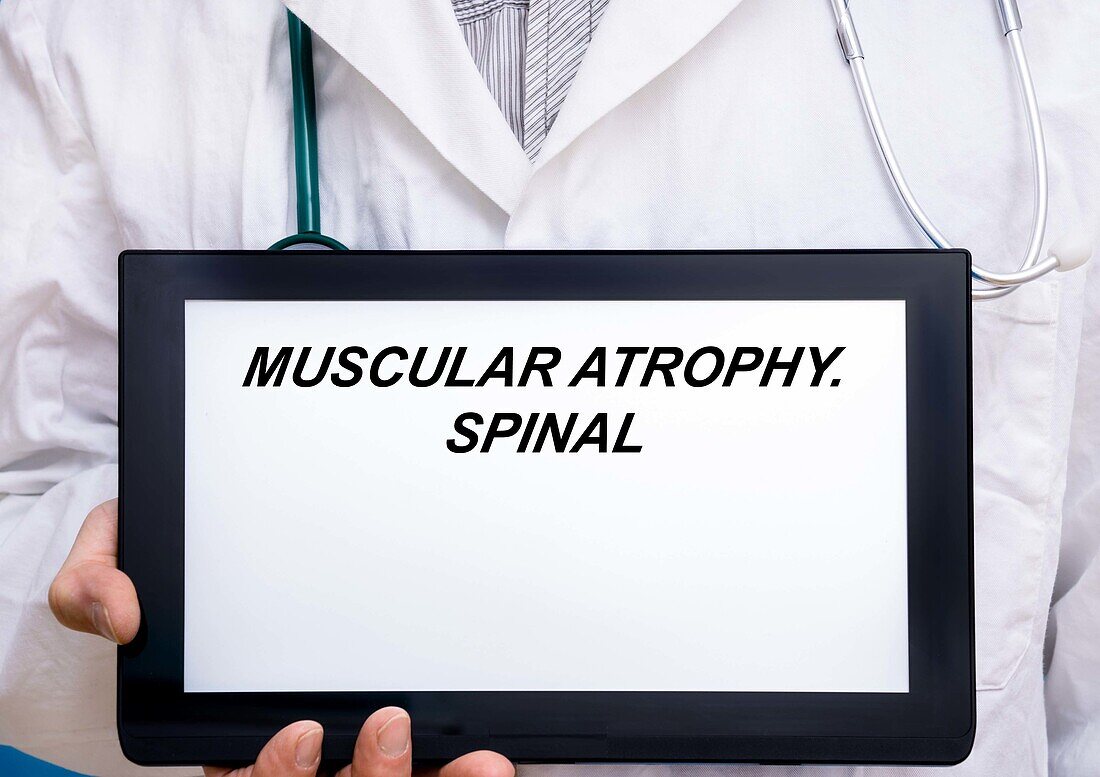 Muscular atrophy, conceptual image