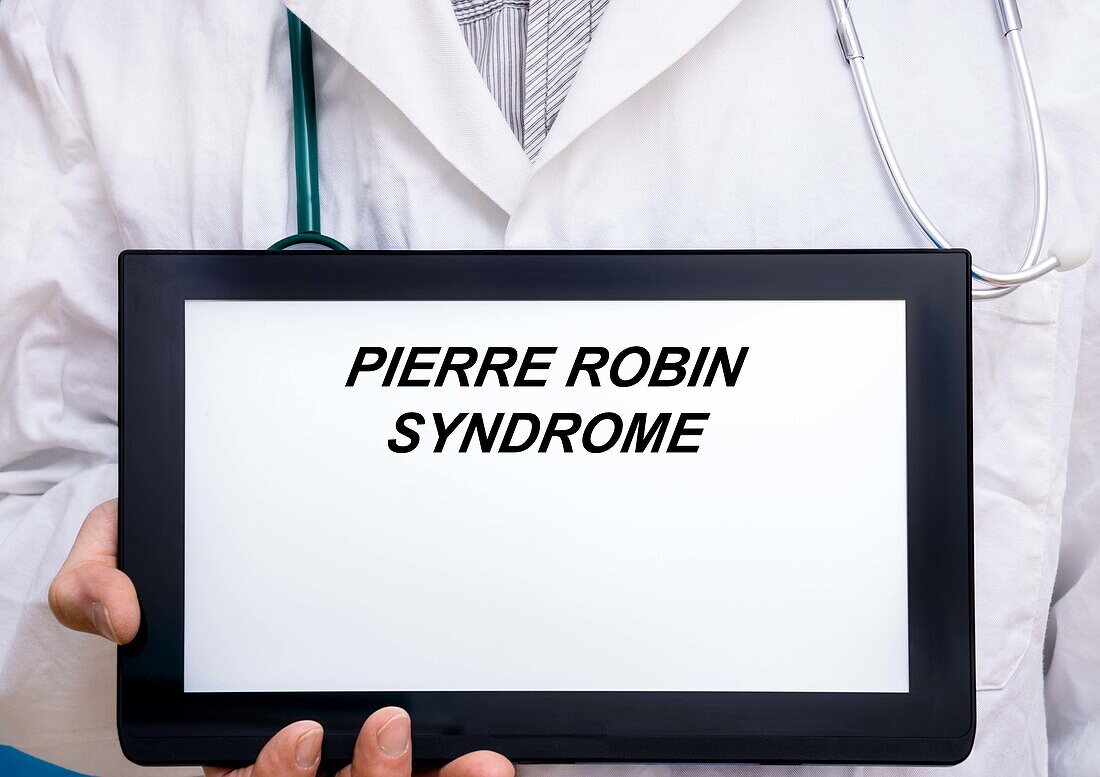 Pierre Robin syndrome, conceptual image