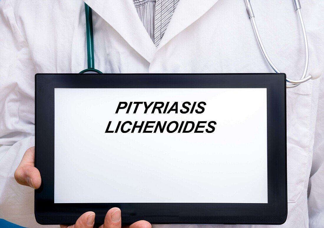 Pityriasis lichenoides, conceptual image