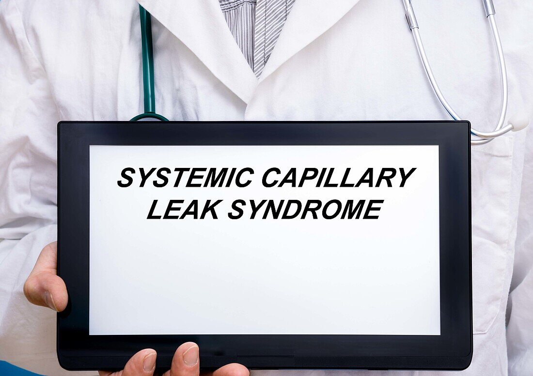 Systemic capillary leak syndrome, conceptual image